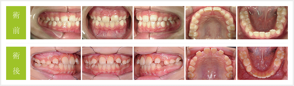 ���ÑO�E���Ì�